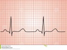 /arquivos/pessoas/125110041119grAfico-normal-da-pulsaCAo-do-coraCAo-ecg-71108214_133_100.jpg